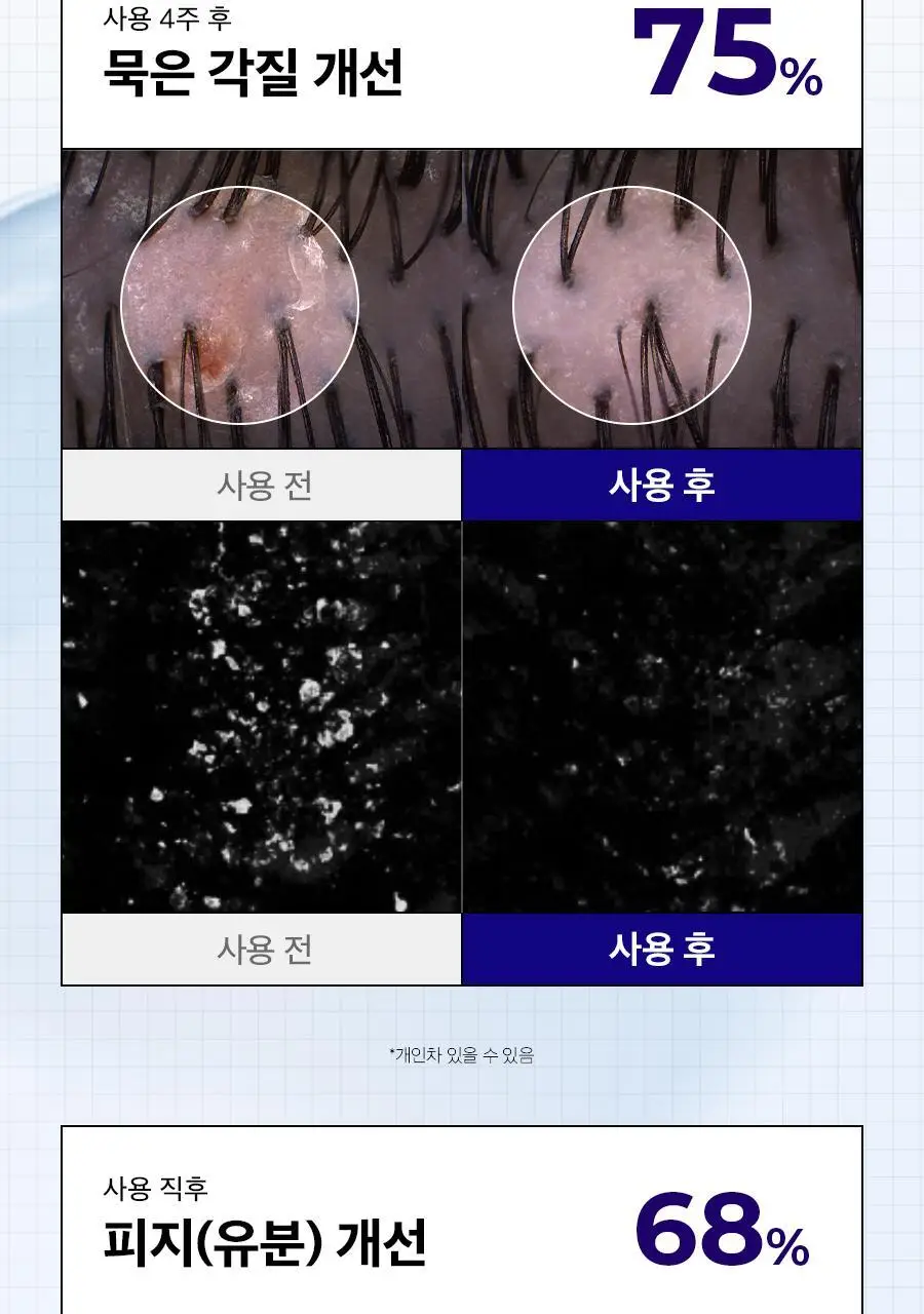 [두피트러블/두피진정]두피랩 쿨 솔트 스칼프 트러블 앰플 15ml 상세페이지 21